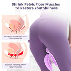 Thigh Master - Pelvic Muscle Trainer